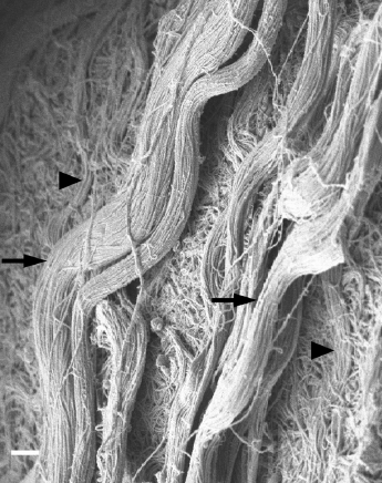 Collagen fibrils are organized into cables in skeletal muscle ECM